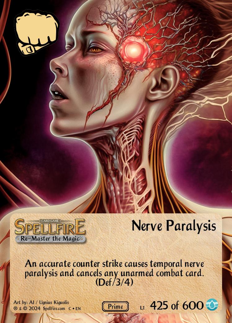 Nerve Paralysis